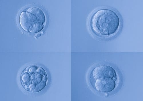 calsificacion de los embriones
