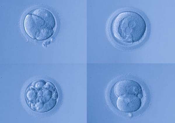 calsificacion de los embriones